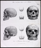 two sets of two different skulls in left profile and full face on one page. smaller engravings of top and back on skull placed between the images.