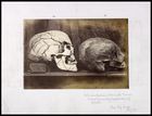 Two skulls sitting on a shelf, one is light in colour, the other is darker and is without jaw both in right profile. Light skull has The great long barrow, Tilshead Wilst, Sept.29, 1865 carved on back right.