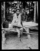 Siamese man from village of Ban-Sai Kau