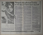 Surgery Has Allowed Society To See Me As I Have Seen Myself'