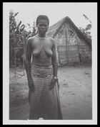 woman with cicatrices on her stomach, standing outside a hut