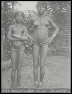 two young girls with cicatrice marks on their stomachs