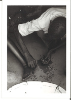 Black and White Photograph of a man with a bleeding foot