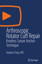 SN Video Medicine and Life Sciences, Arthroscopic Rotator Cuff Repair