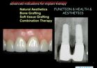 Advanced Implant Therapy, 3, Horizontal Bone augmentation using bone grafts and resorbable membranes