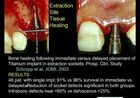 Advanced Implant Therapy, 5, Extraction site bone grafts and immediate vs. delayed implant placement