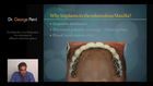 The Edentulous Jaw Restoration: An evaluation of different restorative options