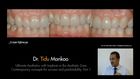 Esthetic Implant Therapy, 2, Achieving Ultimate Aesthetics with Implants in the Aesthetic Zone: Lecture I