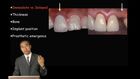 Immediate Implant Placement in the Esthetic Zone