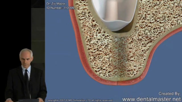 The Art of Sinus Augmentation - Current and Future Trends | Alexander  Street, part of Clarivate