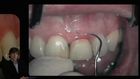 Oral Plastic Surgery