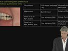 Restorative Excellence - Occlusion on Implant Retained Restorations