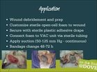 Vacuum Assisted Wound Closure