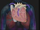 Nursing Assessment, The Cardiovascular System, Part 1: Anatomy and Subjective Data