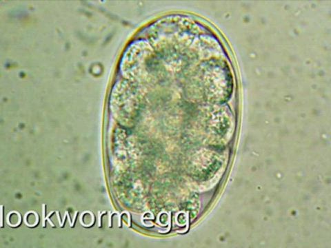parasite eggs in stool