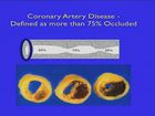 Echocardiographic Evaluation of Coronary Artery Disease