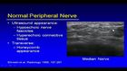 Musculoskeletal Ultrasound: Peripheral Nerve Entrapment
