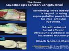 MSK Ultrasound Evaluation of the Knee