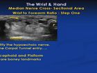Ultrasound Evaluation of the Wrist and Hand