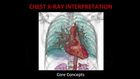 Chest X-Ray Interpretation, Part 1, Introduction, Techniques, and Technical Adequacy