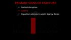 Emergency X-Ray Interpretation, Basic Principles and Terminology