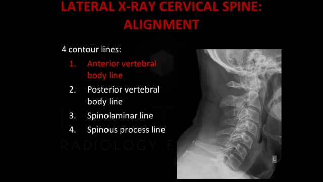 healthy cervical spine xray
