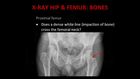 Emergency X-Ray Interpretation, Part 5, Lower Limb