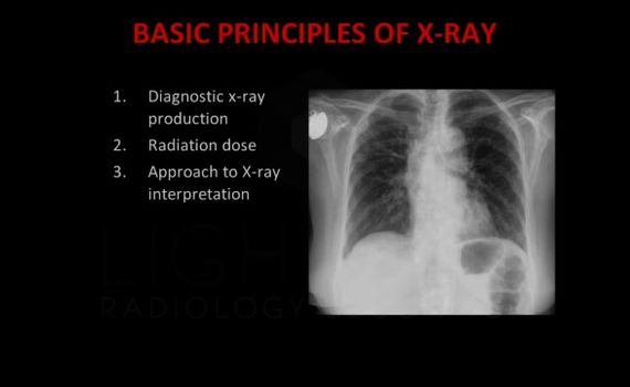 Introduction To X Ray Alexander Street A Proquest Company 9445