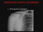 Nursing X-Ray Interpretation, Part 5, Shoulder