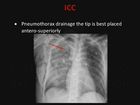 Nursing X-Ray Interpretation, Part 9, Tubes and Lines