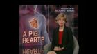 60 Minutes, A Pig Heart? (Xeno Transplant)