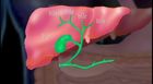 Anatomy and Physiology, The Digestive System: Gallbladder, Pancreas, And Liver
