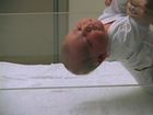 Pediatric Physical Assessment, Assessment of the Head in Pediatric Physicals