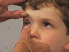 Pediatric Physical Assessment, Assessment of the Eyes in Pediatric Physicals