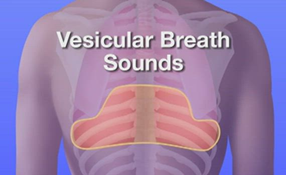 bronchial vesicular breath sounds