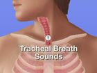 Auscultation of Breath Sounds: Normal Breath Sounds, Episode 8, Auscultation of breath sounds: Using anterior landmarks in auscultation of breath sounds