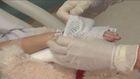 Intravenous Therapy, Pediatric IV therapy: Strategies and methods to protect the IV site