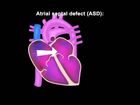 Assessment of the Newborn, Cardiopulmonary Assessment and Cardiac Anomalies: Cardiac anomalies