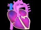 Assessment of the Newborn, Cardiopulmonary Assessment and Cardiac Anomalies: Indicators of cardiac anomalies