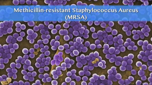 Infection Control In Healthcare Multi Drug Resistant Organisms Mrsa Causes Risk Factors And Treatments Alexander Street A Proquest Company