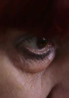 Person's eye