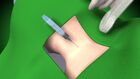 Central Venous Catheter Insertion Animated Demonstration