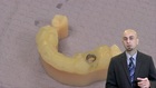 Delivery of Immediate Final Restorations at the Time of Implant Surgery - A Comprehensive Digital Approach to Implant Dentistry